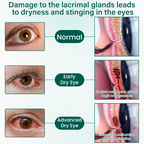 Ceoerty® OptiClear Nano Eye Roller Serum